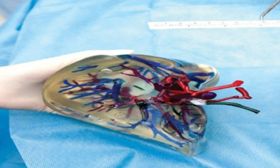 Για πρώτη φορά στην Ελλάδα εγχειρίσεις σε 3D μοντέλα ανθρωπίνων οργάνων