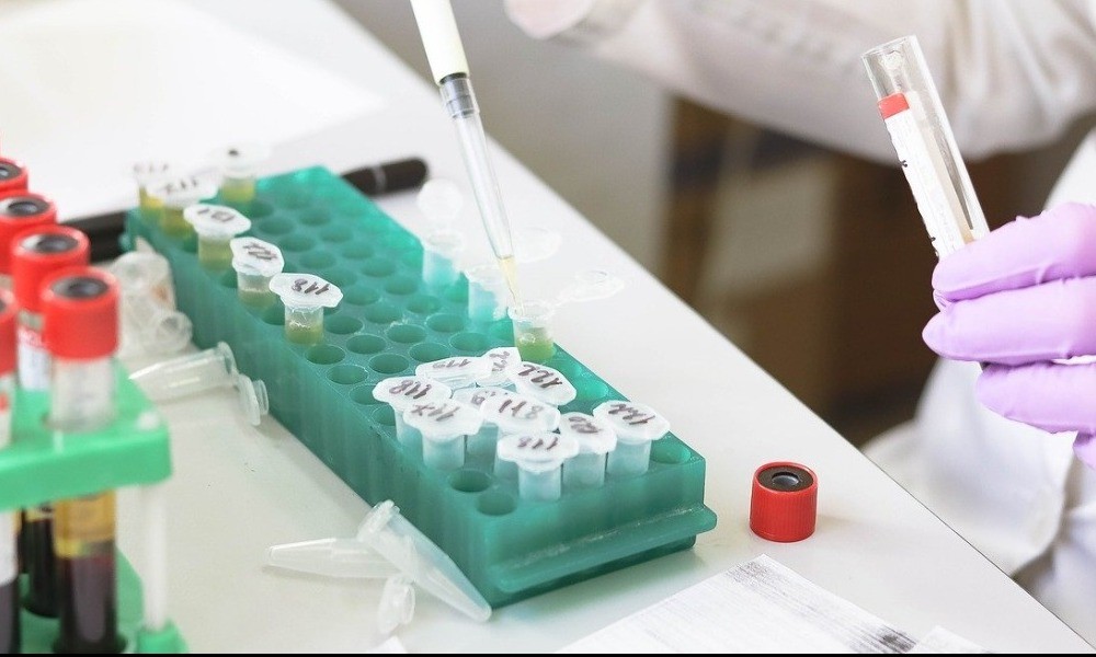 Η Κίνα ετοιμάζει 100 εκατομμύρια δόσεις εμβολίου Coronavac για τον κορωνοϊό