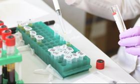Η Κίνα ετοιμάζει 100 εκατομμύρια δόσεις εμβολίου Coronavac για τον κορωνοϊό